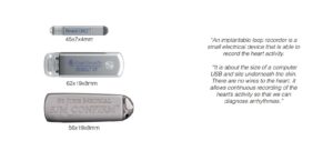 Implantabe Loop Recorder, Melbourne Heart Rhythm